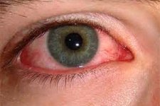 7867-ofoonat-cheshm.jpg 7867-ofoonat-cheshm.jpg